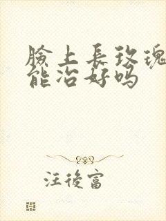 脸上长玫瑰痤疮能冶好吗