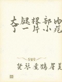 大腿根部内侧起了一片小疙瘩