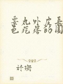 睾丸外皮长个白色疙瘩的图片