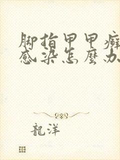 脚指甲甲癣真菌感染怎么办