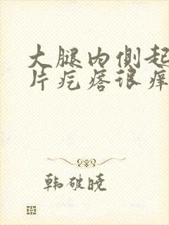 大腿内侧起了一片疙瘩很痒怎么回事