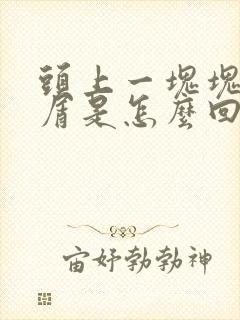 头上一块块头皮屑是怎么回事封面