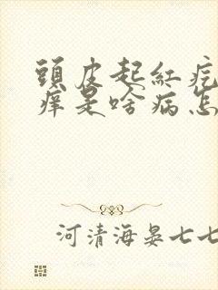 头皮起红疙瘩发痒是啥病怎么治疗