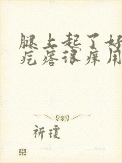 腿上起了好多红疙瘩很痒用什么药