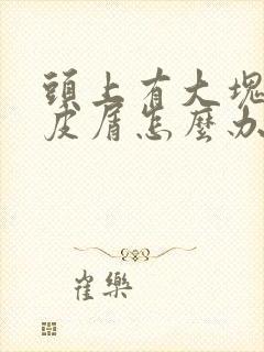 头上有大块的头皮屑怎么办封面