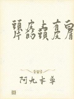 头皮上有白色大片的头皮屑是怎么回事