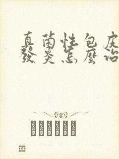 真菌性包皮龟头发炎怎么治疗