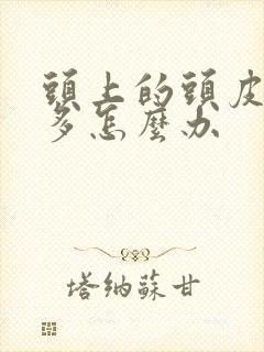 头上的头皮屑太多怎么办