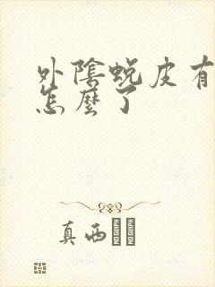 外阴蜕皮有点痒怎么了