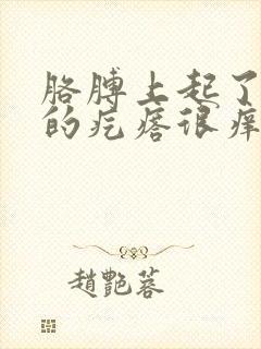 胳膊上起了红色的疙瘩很痒