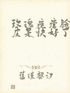 玫瑰痤疮脸上脱皮是快好了吗