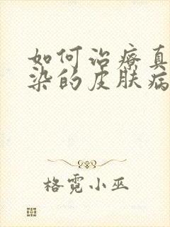 如何治疗真菌感染的皮肤病