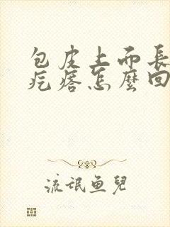 包皮上面长了小疙瘩怎么回事