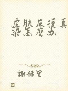 皮肤反复真菌感染怎么办