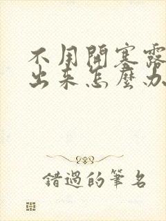 不用开塞露拉不出来怎么办