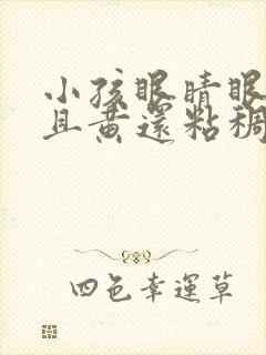 小孩眼睛眼屎多且黄还粘稠怎么办