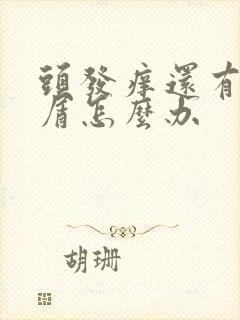 头发痒还有头皮屑怎么办