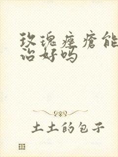 玫瑰痤疮能彻底治好吗