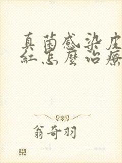 真菌感染皮肤发红怎么治疗