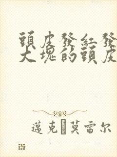 头皮发红发痒有大块的头皮屑是怎么回事