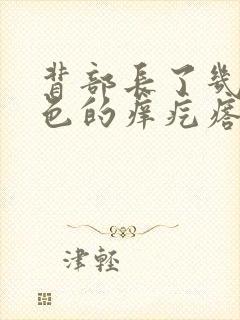 背部长了几个红色的痒疙瘩封面