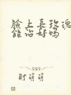 脸上长玫瑰痤疮能治好吗