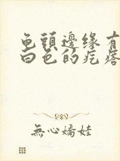 龟头边缘有一排白色的疙瘩封面