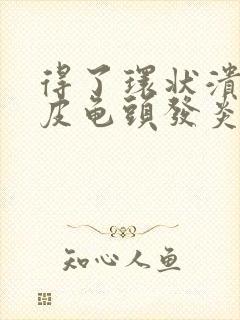 得了环状溃烂包皮龟头发炎怎么办