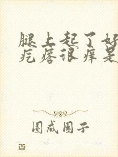 腿上起了好多红疙瘩很痒是什么