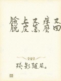 脸上又痒又干又脱皮怎么回事