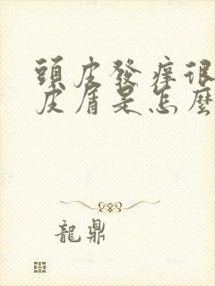 头皮发痒很多头皮屑是怎么回事,怎么解决