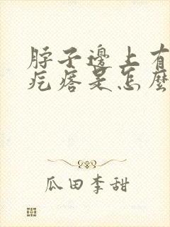 脖子边上有个小疙瘩是怎么回事