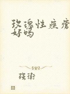 玫瑰性痤疮能治好吗