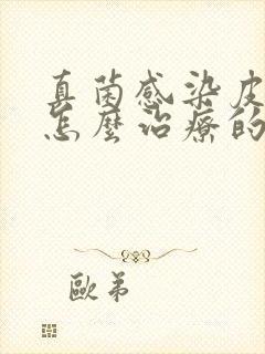 真菌感染皮肤病怎么治疗的