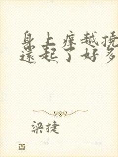 身上痒越挠越痒还起了好多疙瘩用什么药膏封面