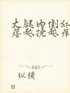 大腿内侧红色疙瘩越挠越痒封面