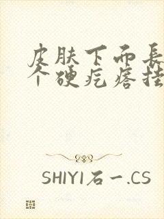 皮肤下面长了一个硬疙瘩挂什么科