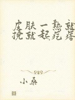 皮肤一热就痒一挠就起疙瘩