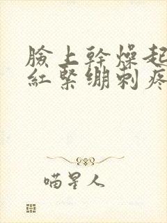 脸上干燥起皮发红紧绷刺疼怎么办