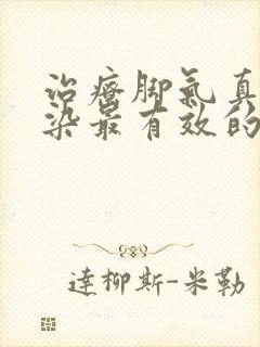 治疗脚气真菌感染最有效的药膏