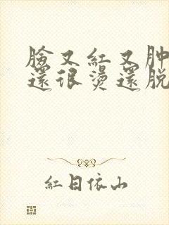 脸又红又肿又痒还很烫还脱皮