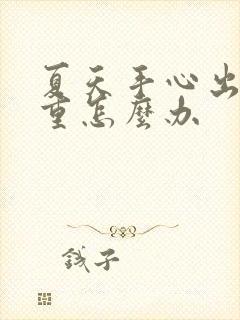 夏天手心出汗严重怎么办