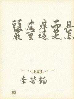 头皮痒而且掉发严重这是怎么回事