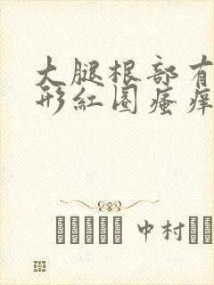 大腿根部有一圆形红圈瘙痒