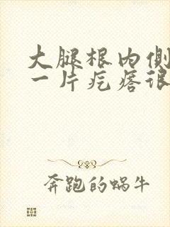 大腿根内侧起了一片疙瘩很痒