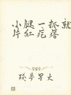 小腿一抓就痒一片红疙瘩