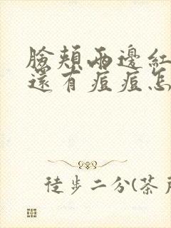 脸颊两边红红的还有痘痘怎么消除