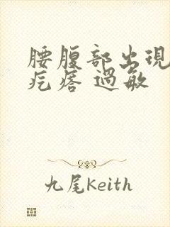 腰腹部出现红色疙瘩 过敏