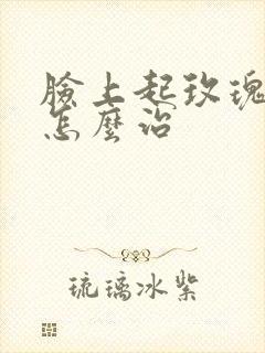 脸上起玫瑰痤疮怎么治封面