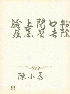 脸上闭口粉刺痘痘怎么去除